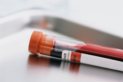 El médico hará un estudio de sangre donde evaluará varios marcadores de la salud cardíaca